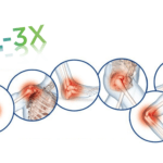 Glukozamin, kondroitin in MSM